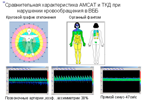 Сравнительная характеристика АМСАТ и ТКД при нарушении кровообращения в вертебрально-базиллярном бассейне (ВББ).